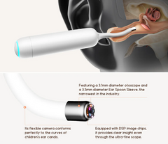 Bebird Home 30S Versatile Ear Camera with Tweezer & Fuild Ear Camera 6 LED Lights 1080P Otoscope