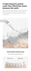 Xiaomi Water Flosser 2 | 3 Flossing Modes | 99.4% Oral Health Cleanser | Up to 90 Days Battery Health
