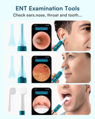 [2026 Model] Bebird EarSight Ultra Ear Wax Cleaner | 5G | 2K Video Otoscope | 90 Mins Battery