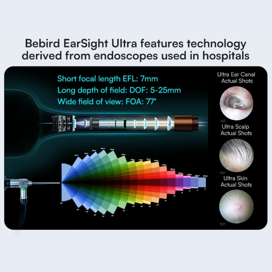 [2026 Model] Bebird EarSight Ultra Ear Wax Cleaner | 5G | 2K Video Otoscope | 90 Mins Battery