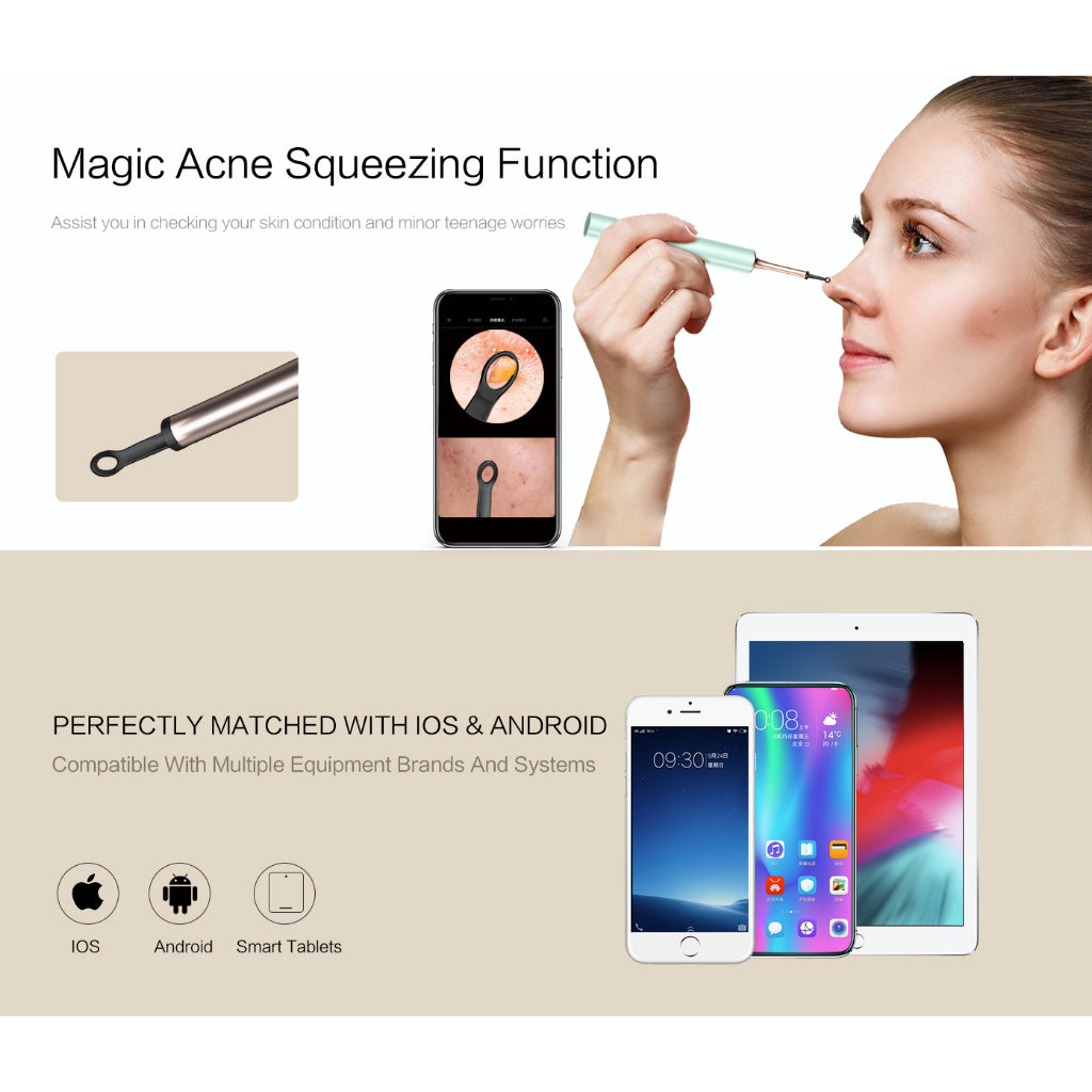 [LOCAL SG] BeBird T15 Smart Otoscope Ear and Pore Cleaning High Precision Camera Tool